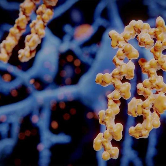 amyloidosis