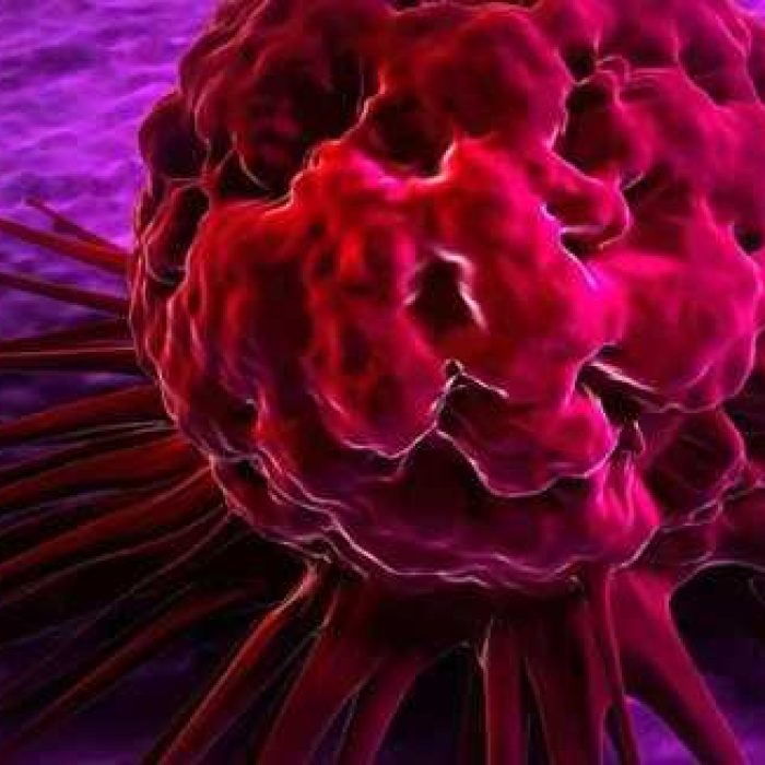 oncology